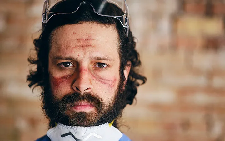 7 Cara Menghindari Iritasi Hidung karena Masker